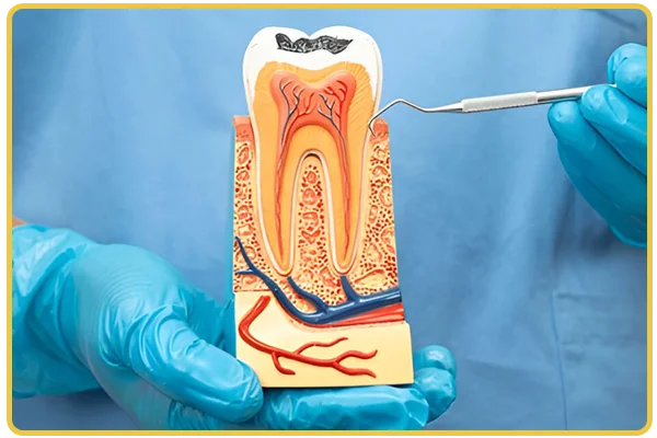 Painless RCT