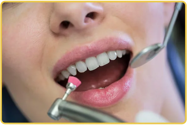 Gum Treatment
